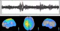 Source reconstructed EEG brain